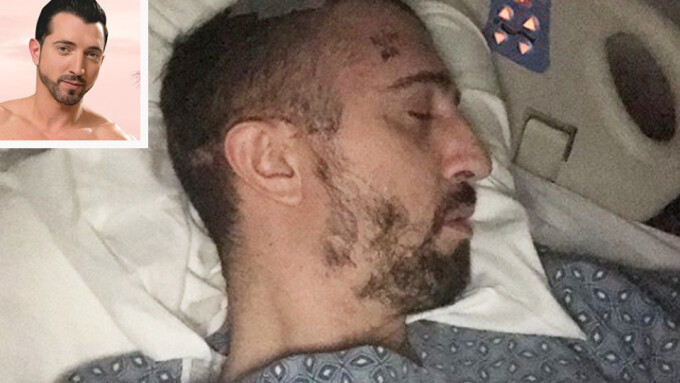 After Serious Accident, GoFundMe Campaign Created for Jimmy Durano