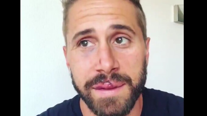 Wesley Woods Discusses West Hollywood Attack in Video