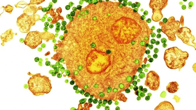 2nd HIV-Positive Patient Reportedly Cured of Infection